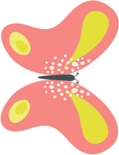 Butterfly 11